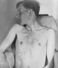 lichtenberg-figurleri-3.webp
