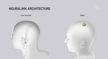 neuralink.webp