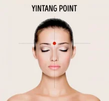 yintang_zpsgd3z7ky8.webp