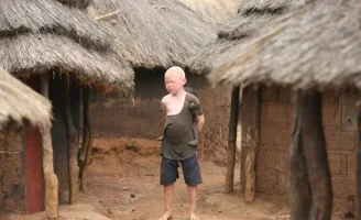 albino1_topragizbizcom_zpsa2693a0e.webp