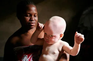 albino3_topragizbizcom_zps141ab0f1.webp
