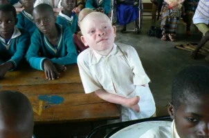 albino5_topragizbizcom_zps16813343.webp