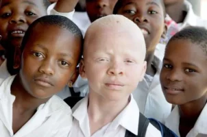 albino6_topragizbizcom_zps61d7fca7.webp