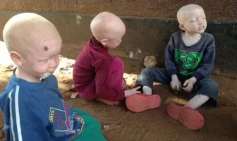 albino2_topragizbizcom_zps832e0e31.webp