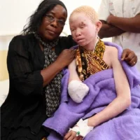 albino10_topragizbizcom_zpsa0be178f.webp