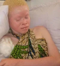 albino9_topragizbizcom_zps3e751fab.webp