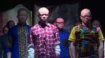 Kenya’da Albino Güzellik Yarışması