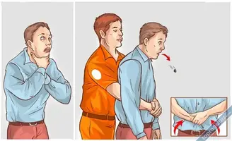 Heimlich Manevrası  Nedir? Nasıl Yapılır?